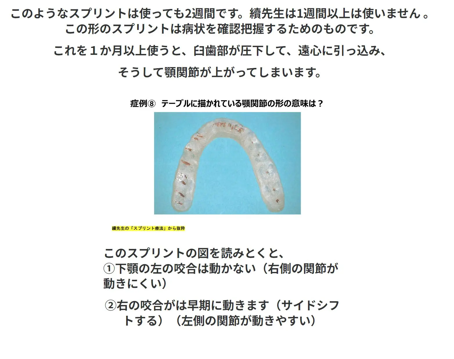 矯正の顎関節症の治療。一般的に使用するスタビライゼーション型